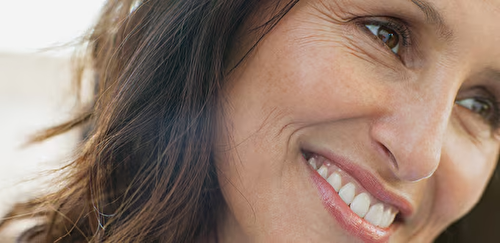 DYSPORT® Cosmetic Wrinkle Treatment - Crow's Feet
