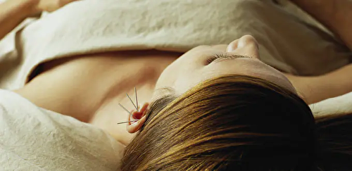 Traditional Chinese Acupuncture - 1 session