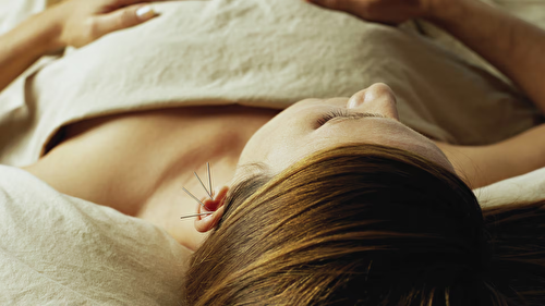 Traditional Chinese Acupuncture - 1 session