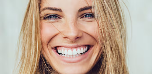 GO SMILE™ Teeth Whitening Treatment