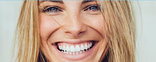 GO SMILE™ Teeth Whitening Treatment