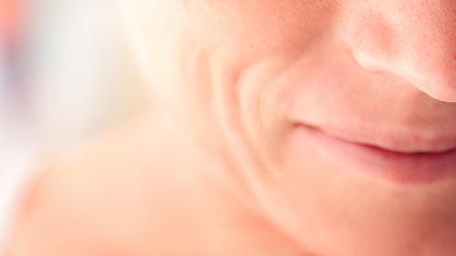 Restylane® Marionette Lines Treatment