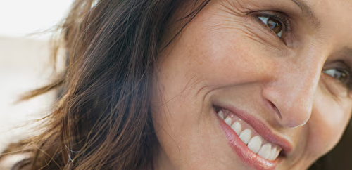 DYSPORT® Cosmetic Wrinkle Treatment - Crow's Feet