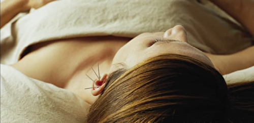 Traditional Chinese Acupuncture - 1 session