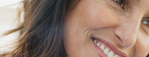 DYSPORT® Cosmetic Wrinkle Treatment - Crow's Feet